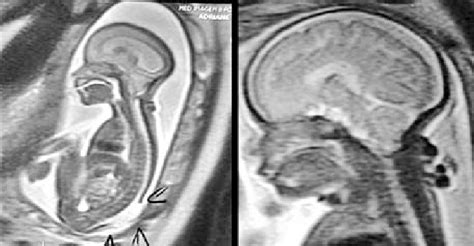 novaris mmc|Radiology .
